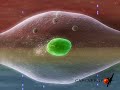 Hipertermia en Psoriasis