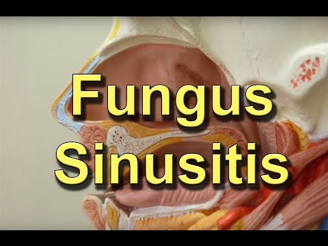 how to eliminate fungus from your body