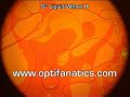 Optikinetics 6\" Liquid Wheel H lighting effect