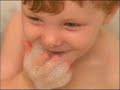Thumbnail #1