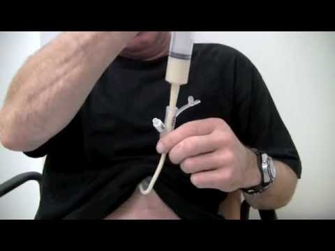 how to unclog a g-tube feeding tube