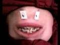 videos de Bob counts