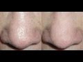 HOW TO: MAKE PORES VANISH!