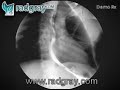 Xray evaluation of esophageal transit video www.radgray.com