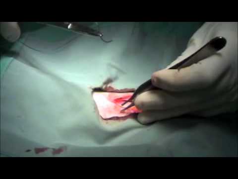 castration