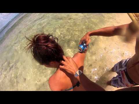 how to treat a portuguese man-o-war sting