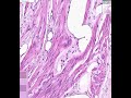 Shotgun Histology Female Urethra Shotgun Histology Female Urethra