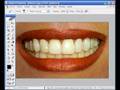 Blanquear dientes con Photoshop