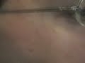 Hoeft Eyes...