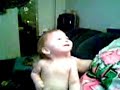 hydrocephalus baby alex Hydrocephalus