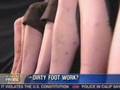 Pedicure Safety Hazards