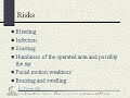 Facelift Risks - Dallas, Plano, Frisco Texas Facelift (Rhytidectomy)