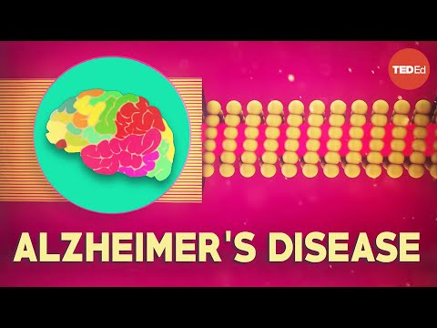 how to cure alzheimer's disease