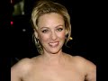 Virginia Madsen talks about her Botox use