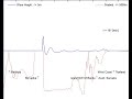 Tsunami 2004 profile simulation - Off the coast of Sumatra