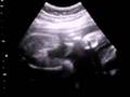 4D Ultrasound 28 Weeks Part 1