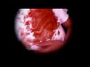 videos de CSI: Hiltrup (Trailer 1)