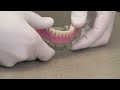 Implant Overdenture or an Implant Retained Denture: http://t.co/uiMjOnAf via @youtube Suwanee Dental Care makes this type overdenture a lot!