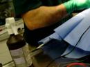 Dog Lumpectomy Part 2 Dog Lumpectomy Part 2