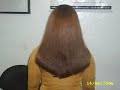 Laser - Photon Hair UOM
