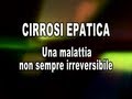 Clicca per visualizzare il video : Cirrosi Epatica: una malattia non sempre irreversibile - Dott. Cosimo Colletta