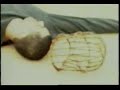 Las Pelotas - Orugas