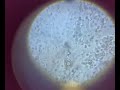 Trichodina