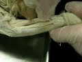 Yeshiva cat dissection 5 Yeshiva cat dissection 5