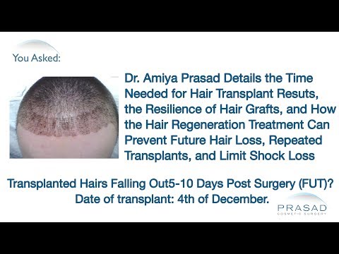 how to reduce swelling after hair transplant