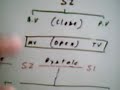 Heart sounds