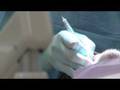 videos de OTC Foundation Campaign Video