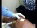 videos de Draining of  synovial fluid & cortisone shot in the knee