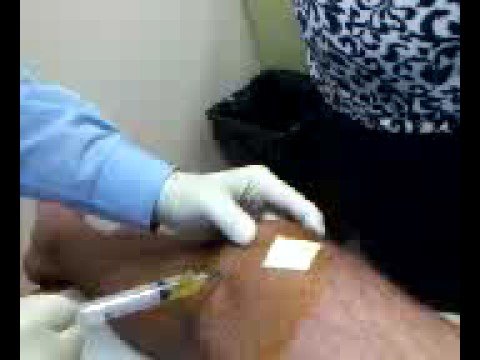 how to drain knee fluid
