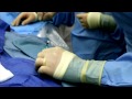 Radial Catheterization.