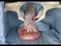 Rectal palpation technique for a pregnant cow ( Pregnancy diagnosis )