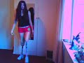 Walking Without Crutch - July 1st
