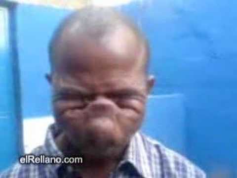 Un Hombre que Asombra por Tener una Gran Lengua