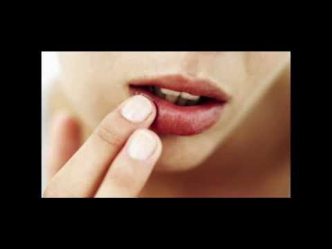 how to treat windburned lips