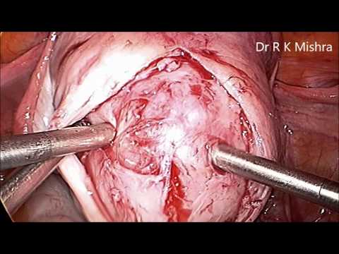 how to locate uterus