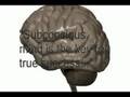 Subliminal CDs Work To Improve Yourself - ChargedAudio.com