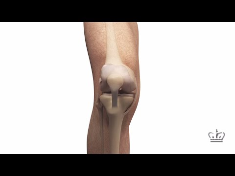 how to tell if meniscus repair is successful