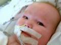 The reality of Congenital Heart Defect, Congenital Diaphragmatic Hernia, and Pentalogy of Cantrell
