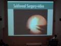 Dr. Robert Devenyi - Behind The Scenes - Part 3