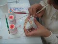 dental ceramics