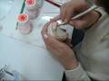dental ceramics