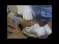 Young boy draining the ARMS -- SYNTHOL VICTIM!