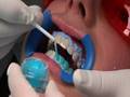 Le blanchiment dentaire film n°1 film pour les dentistes.