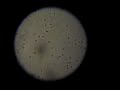 My sperm Under Microscope My sperm Under Microscope