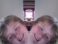 two headed boy