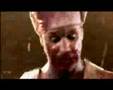 Assistir ao v�deo
